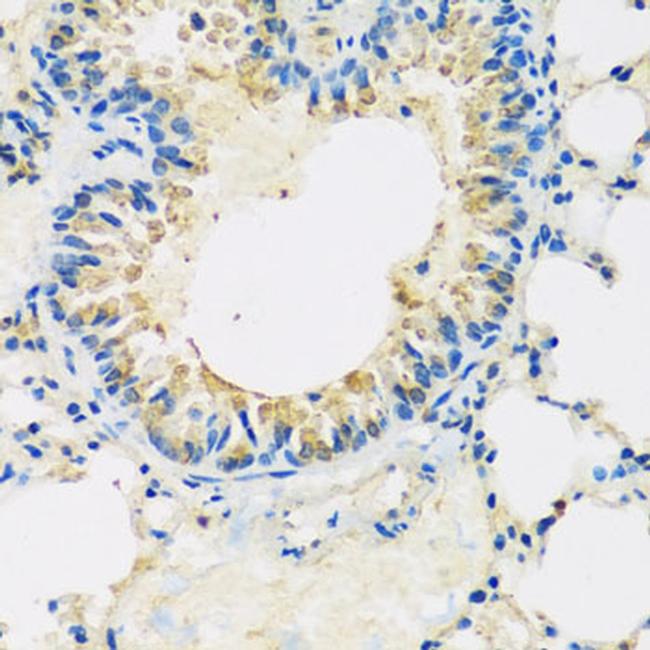 ABCF2 Antibody in Immunohistochemistry (Paraffin) (IHC (P))