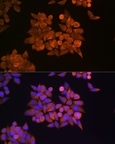 eRF1 Antibody in Immunocytochemistry (ICC/IF)