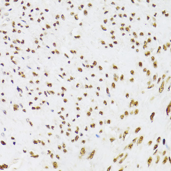 Ku70 Antibody in Immunohistochemistry (Paraffin) (IHC (P))