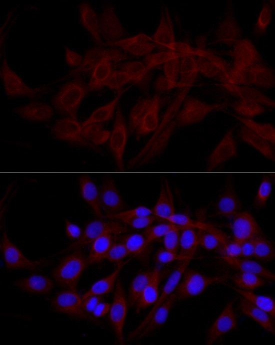 CALCOCO2 Antibody in Immunocytochemistry (ICC/IF)