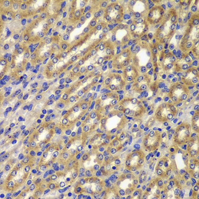 Cyclin A2 Antibody in Immunohistochemistry (Paraffin) (IHC (P))