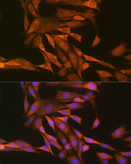 Thioredoxin 1 Antibody in Immunocytochemistry (ICC/IF)