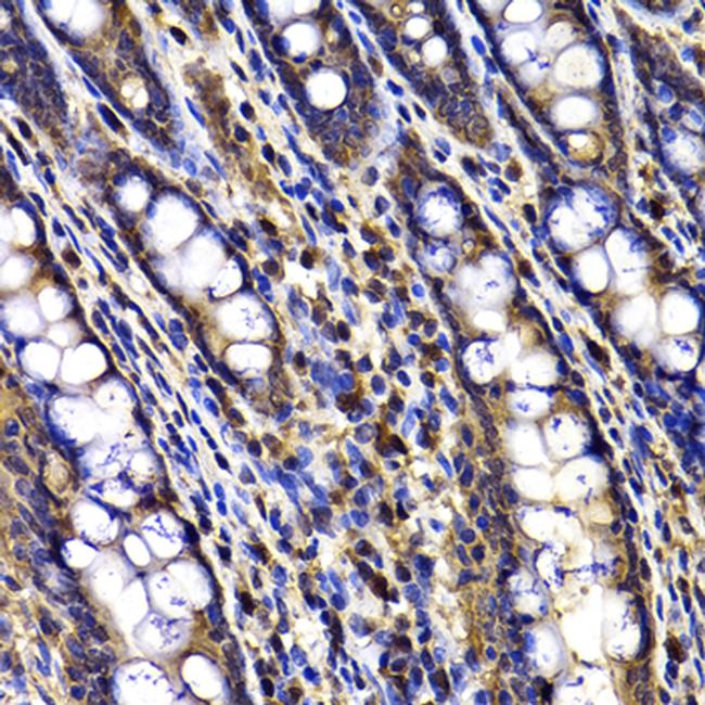 DRIL1 Antibody in Immunohistochemistry (Paraffin) (IHC (P))