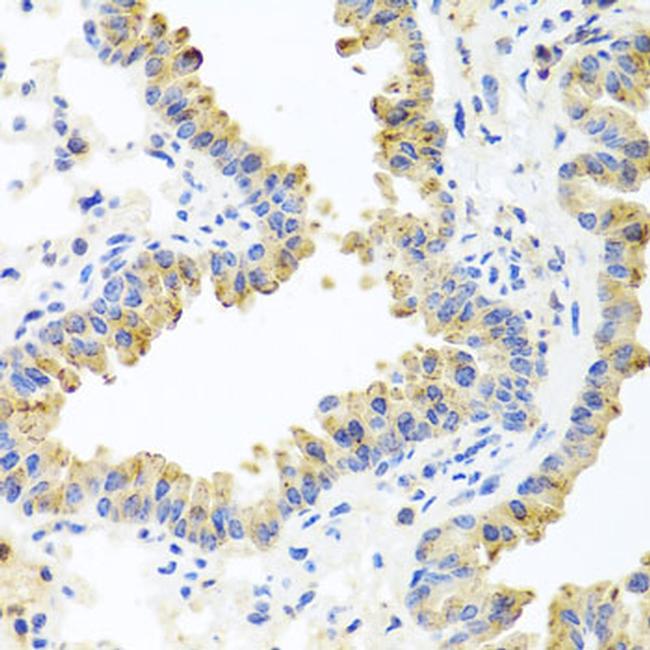 HSPA6 Antibody in Immunohistochemistry (Paraffin) (IHC (P))