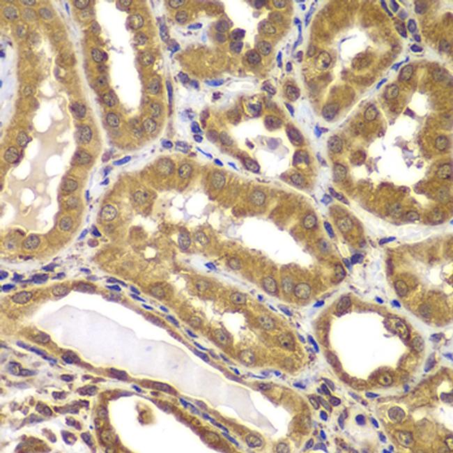 PSEN2 Antibody in Immunohistochemistry (Paraffin) (IHC (P))