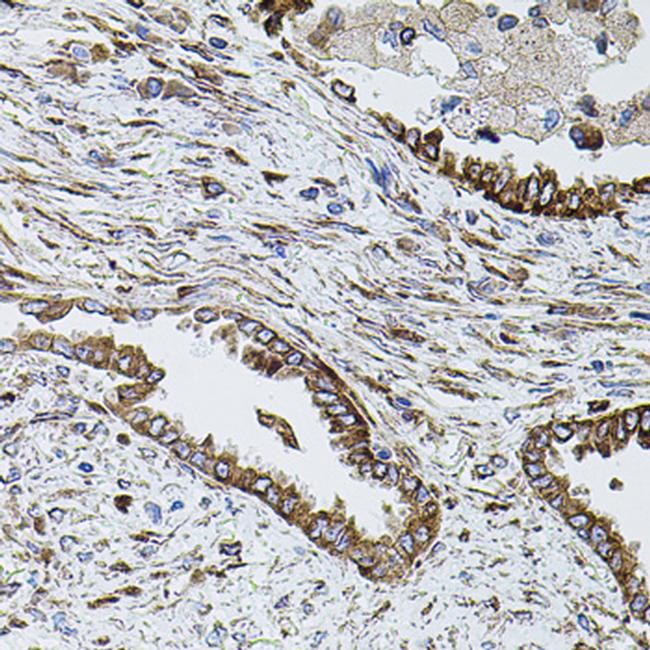 SHH Antibody in Immunohistochemistry (Paraffin) (IHC (P))