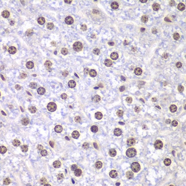 TOP1 Antibody in Immunohistochemistry (Paraffin) (IHC (P))