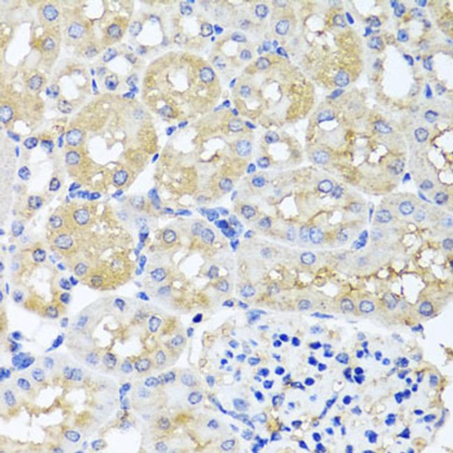 HARS2 Antibody in Immunohistochemistry (Paraffin) (IHC (P))