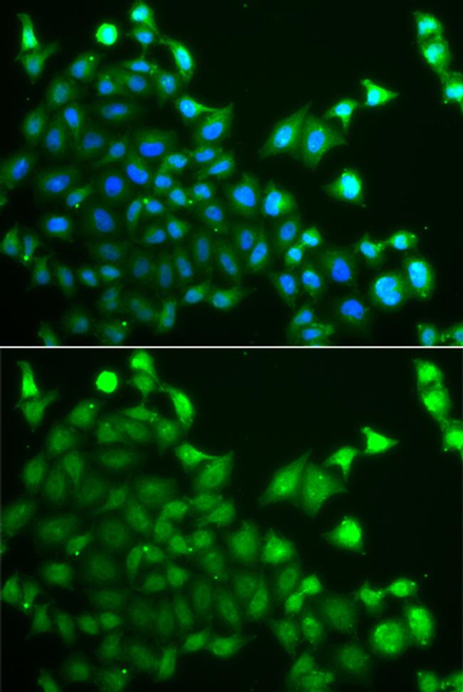 CBLC Antibody in Immunocytochemistry (ICC/IF)