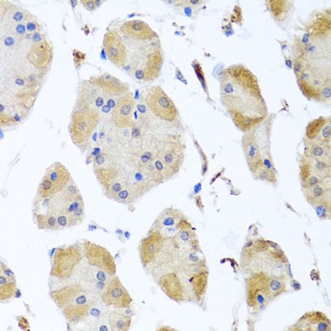 MYLK Antibody in Immunohistochemistry (Paraffin) (IHC (P))