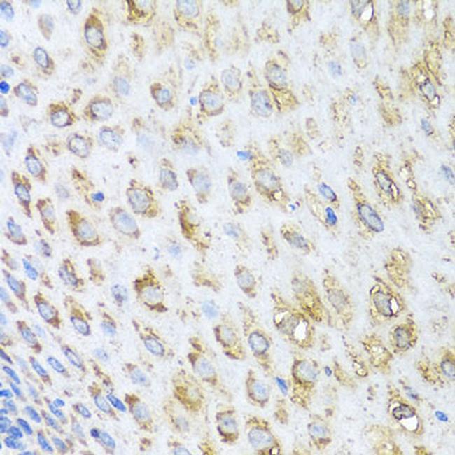 MST1 (STK4) Antibody in Immunohistochemistry (Paraffin) (IHC (P))