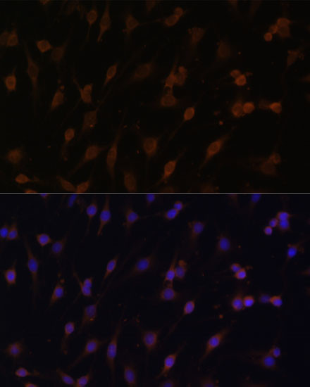 Cytochrome P450 Reductase Antibody in Immunocytochemistry (ICC/IF)