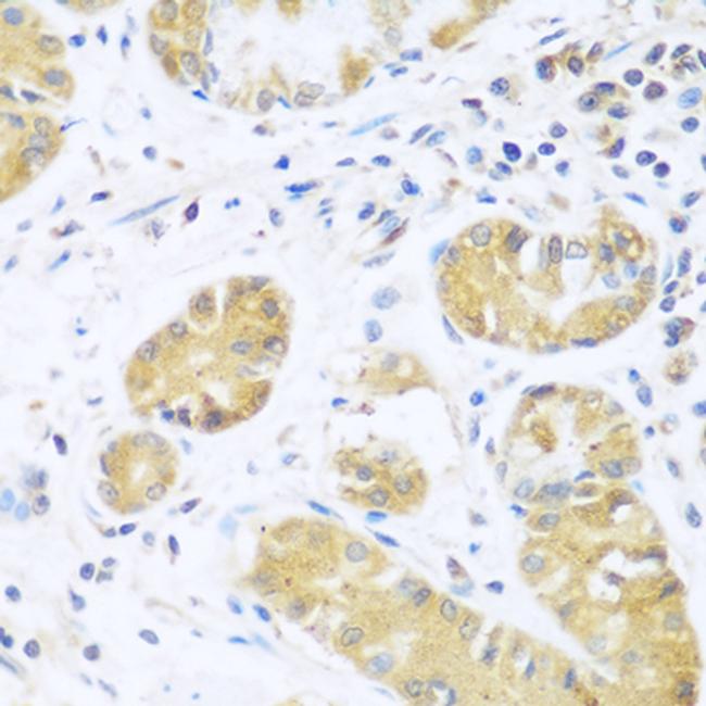 UCHL3 Antibody in Immunohistochemistry (Paraffin) (IHC (P))