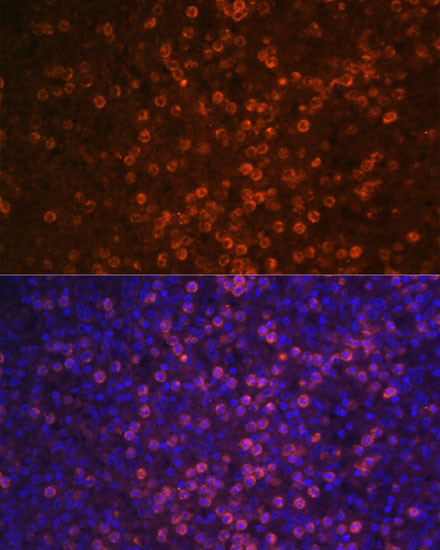 CD21 Antibody in Immunocytochemistry (ICC/IF)