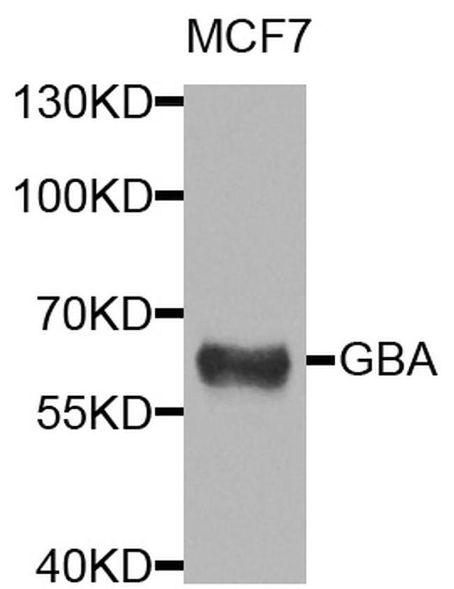 GBA Antibody in Western Blot (WB)