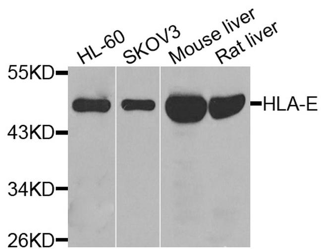 HLA-E Antibody in Western Blot (WB)