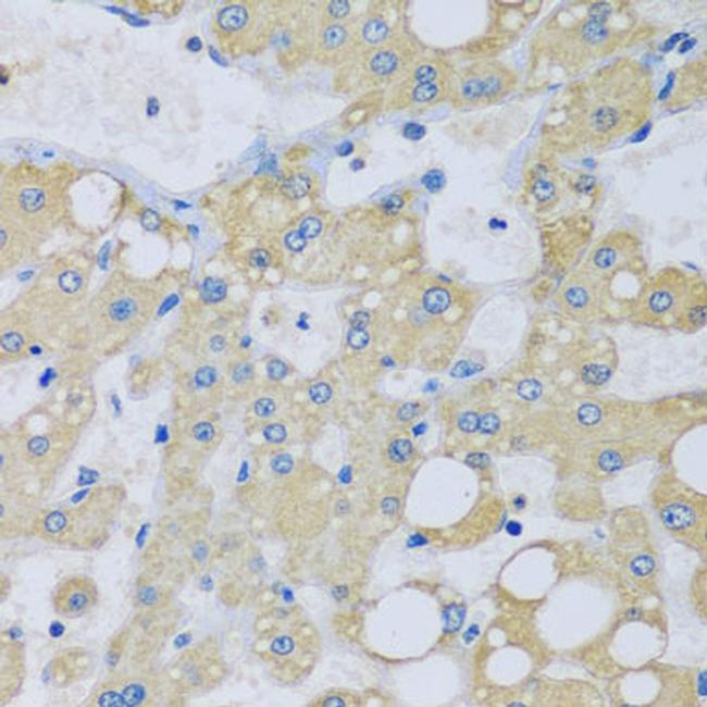 NDUFA7 Antibody in Immunohistochemistry (Paraffin) (IHC (P))