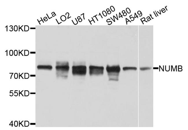 NUMB Antibody in Western Blot (WB)