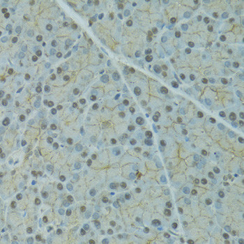 SERPINF2 Antibody in Immunohistochemistry (Paraffin) (IHC (P))