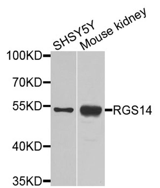 RGS14 Antibody in Western Blot (WB)