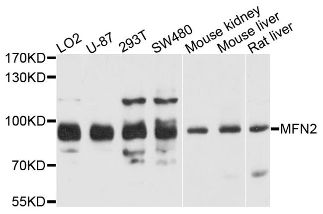 MFN2 Antibody in Western Blot (WB)