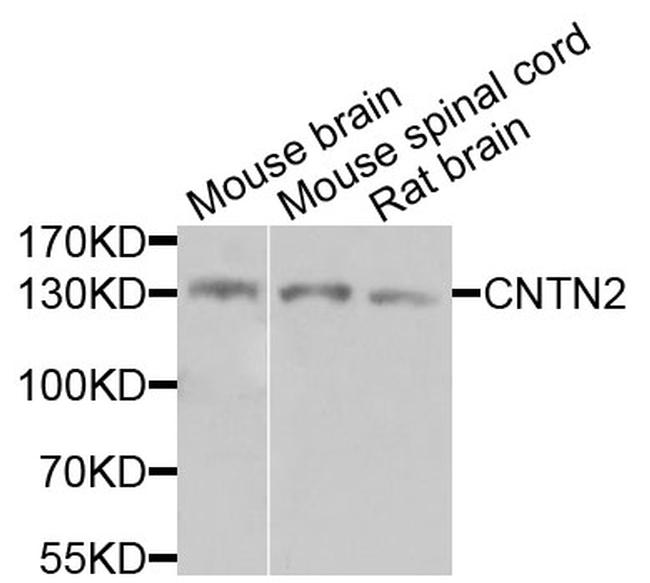 Contactin 2 Antibody in Western Blot (WB)