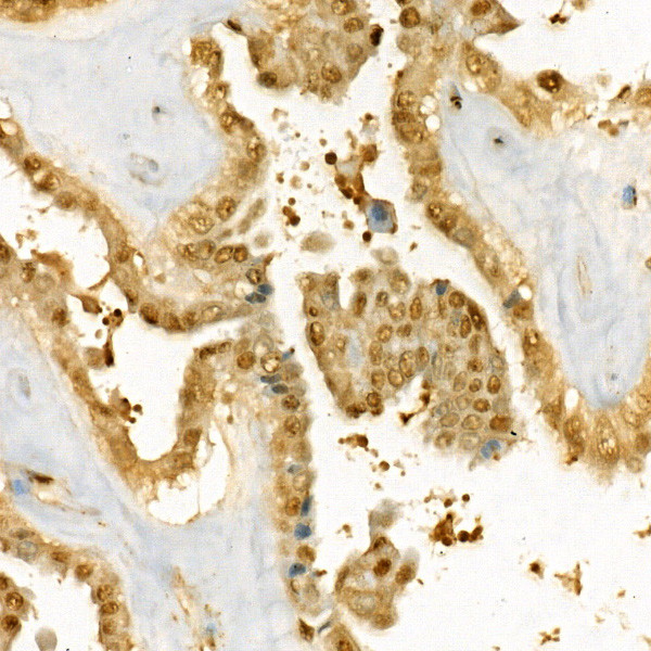 Thymidylate Synthase Antibody in Immunohistochemistry (Paraffin) (IHC (P))