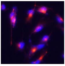 Nestin Antibody in Immunocytochemistry (ICC/IF)