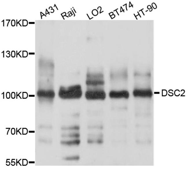 Desmocollin 2 Antibody in Western Blot (WB)