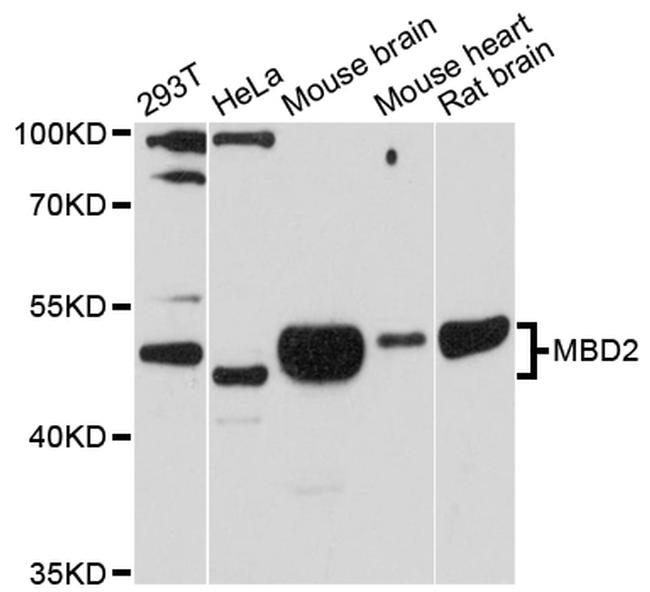 MBD2 Antibody in Western Blot (WB)