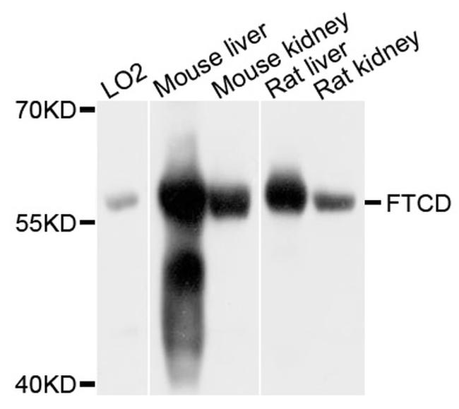 Golgi protein 58k Antibody in Western Blot (WB)