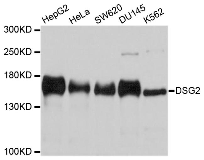 Desmoglein 2 Antibody in Western Blot (WB)