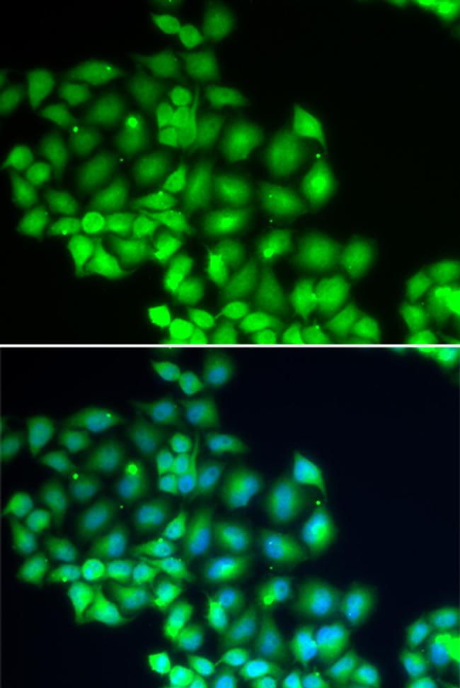 XPD Antibody in Immunocytochemistry (ICC/IF)