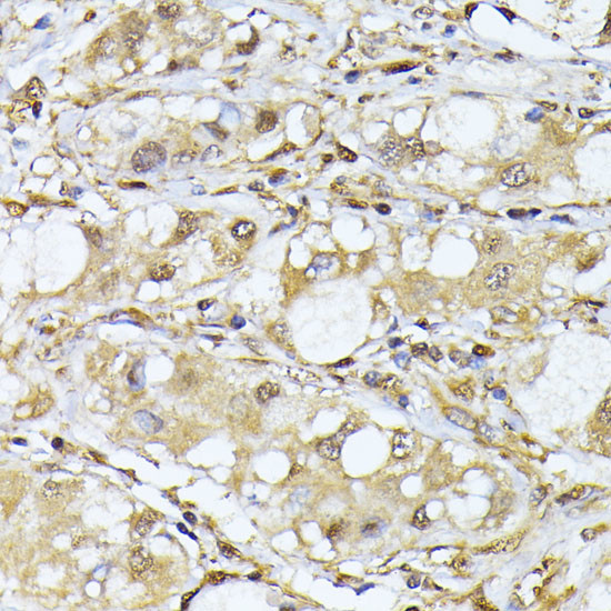 PSMA7 Antibody in Immunohistochemistry (Paraffin) (IHC (P))