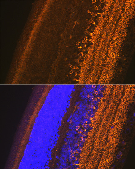 GAD67 Antibody in Immunocytochemistry (ICC/IF)