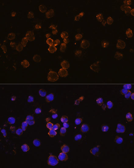 CD254 (RANK Ligand) Antibody in Immunocytochemistry (ICC/IF)