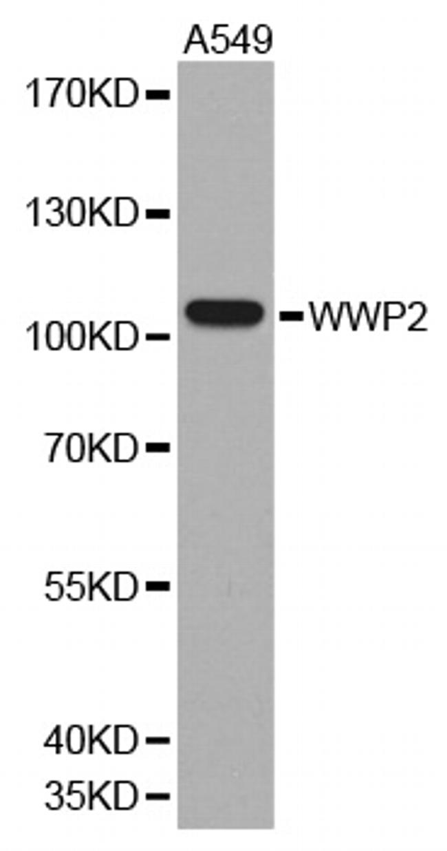 AIP2 Antibody in Western Blot (WB)