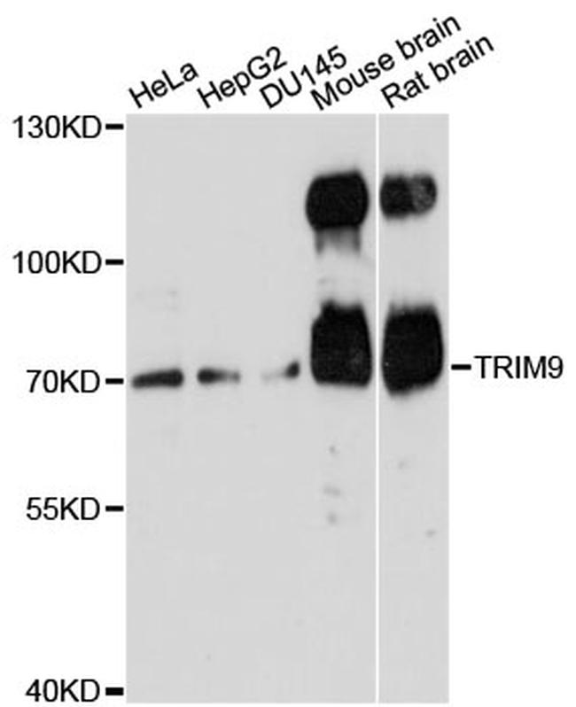 TRIM9 Antibody in Western Blot (WB)