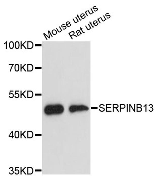 SERPINB13 Antibody in Western Blot (WB)