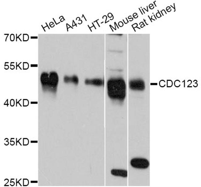 CDC123 Antibody in Western Blot (WB)