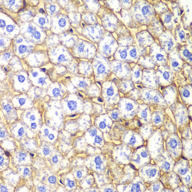 N-cadherin Antibody in Immunohistochemistry (Paraffin) (IHC (P))