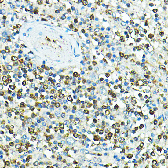 CD79a Antibody in Immunohistochemistry (Paraffin) (IHC (P))