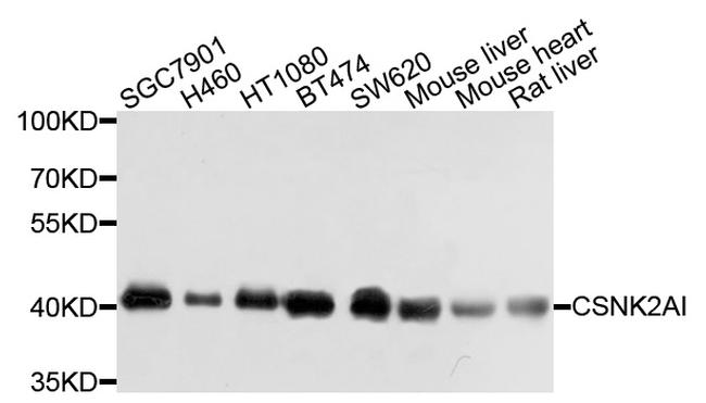 CK2 alpha-1 Antibody in Western Blot (WB)