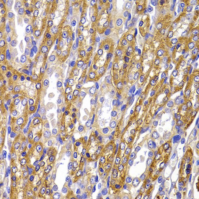 ATP1A1 Antibody in Immunohistochemistry (Paraffin) (IHC (P))