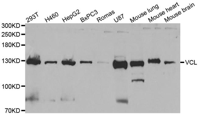 Vinculin Antibody in Western Blot (WB)