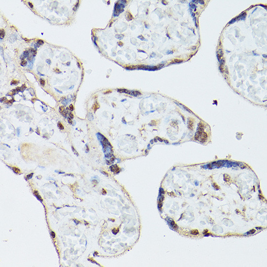 Adenosine Kinase Antibody in Immunohistochemistry (Paraffin) (IHC (P))