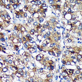 PYCR2 Antibody in Immunohistochemistry (Paraffin) (IHC (P))