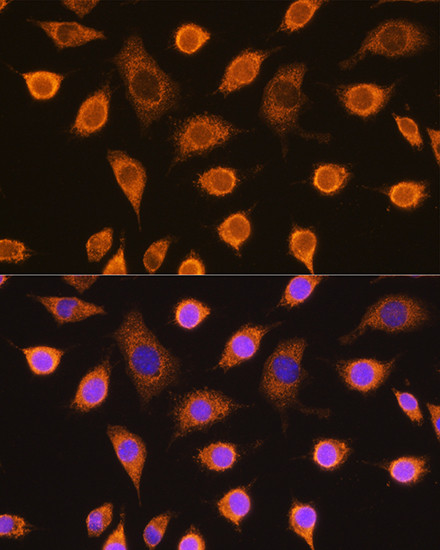 SDHB Antibody in Immunocytochemistry (ICC/IF)