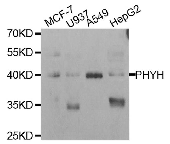 PHYH Antibody in Western Blot (WB)