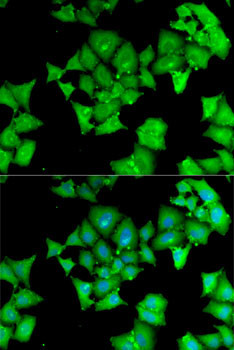 Aminoacylase Antibody in Immunocytochemistry (ICC/IF)